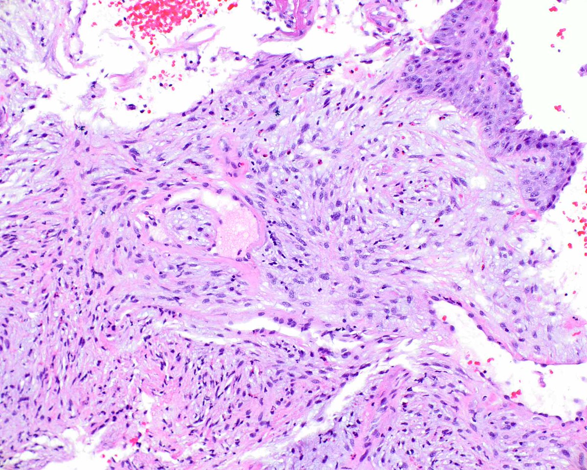UMiami Pathology tweet media
