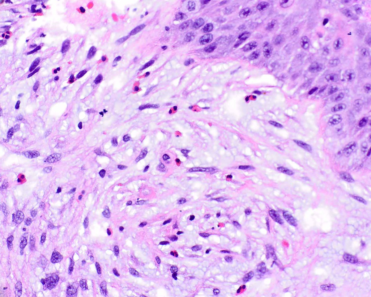 UMiami Pathology tweet media