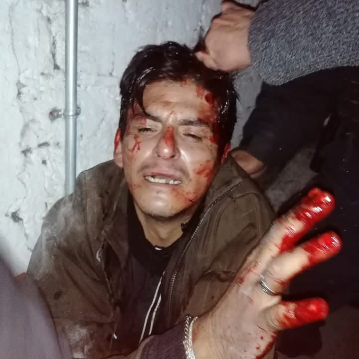 Tania_aguilarcr's tweet photo. 🚨Intentan #linchar a las ratas en #TLALPAN. Cansados de la #inseguridad, vecinos de San Andrés Totoltepec golpearon a estos sujetos que ya llevan tiempo robando en la zona. Policías de la @SSC_CDMX se los llevaron antes de que los mataran, en @TlalpanAl. https://t.co/kuB9BUWoTi