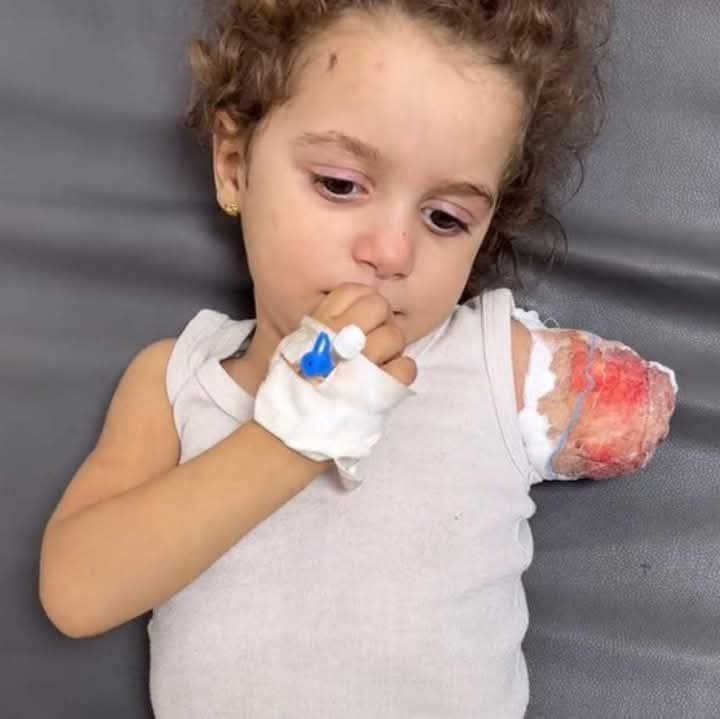 "ما ذنب الفراشات، حتى قصوا أجنحتها"؟!

طفلة فلسطينية أصيبت بقصف الاحتلال على قطاع غزة، ما أدى لبتر يدها.