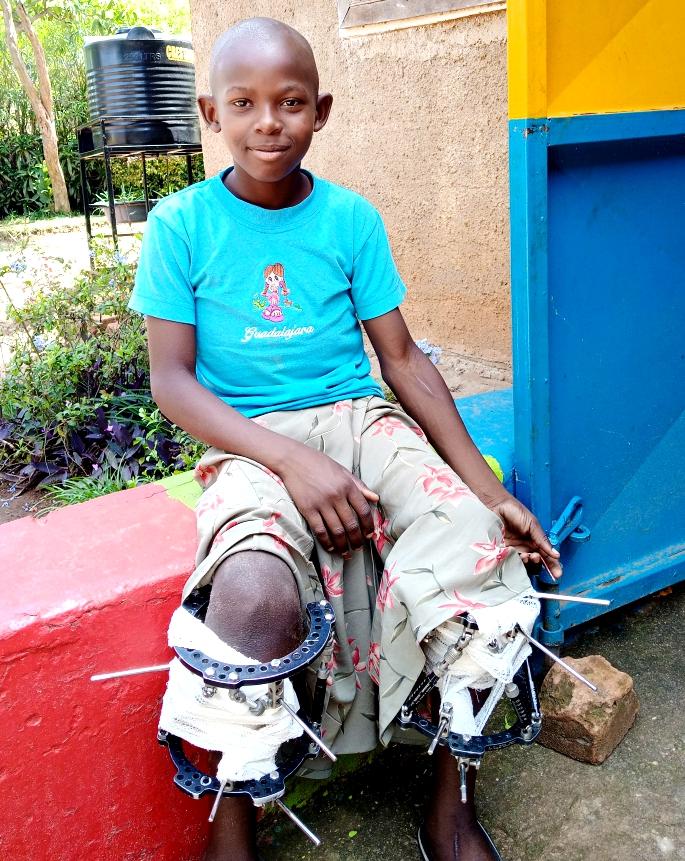 Meet our Ninja! Walking with bravery to recovery after enduring painful surgeries &amp; procedures. We Focus on progress #RecoveryJourney #Strength #NoGivingUp