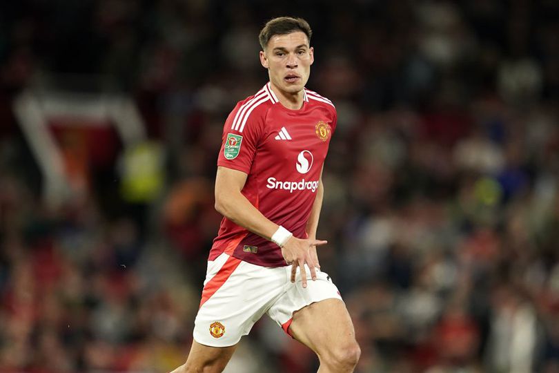 Ugarte was fabolous today! 

His energy, tenacity, ground covering, duel winning, ability to keep it simple was all on display today and shown in the statistics. 

It is CRITICAL United find the right partner for him this summer.

#MUFC