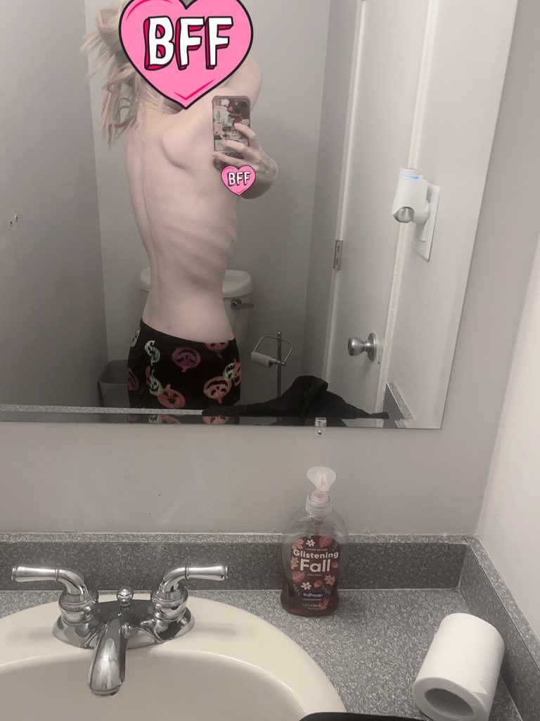 strvingpity's tweet photo. Do I need to show my fucking b0nes to prove myself wtf?? https://t.co/5hqqBbTvYl