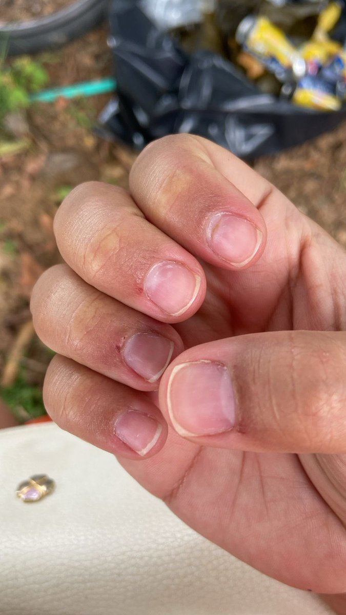 Si tienen la oportunidad de ir a ese salón de liced Pérez ( guaduales) NO lo hagan!! 
Fui por un retiro de esmalte semipermanente y casi salgo sin dedos 🥴🥴🥴
