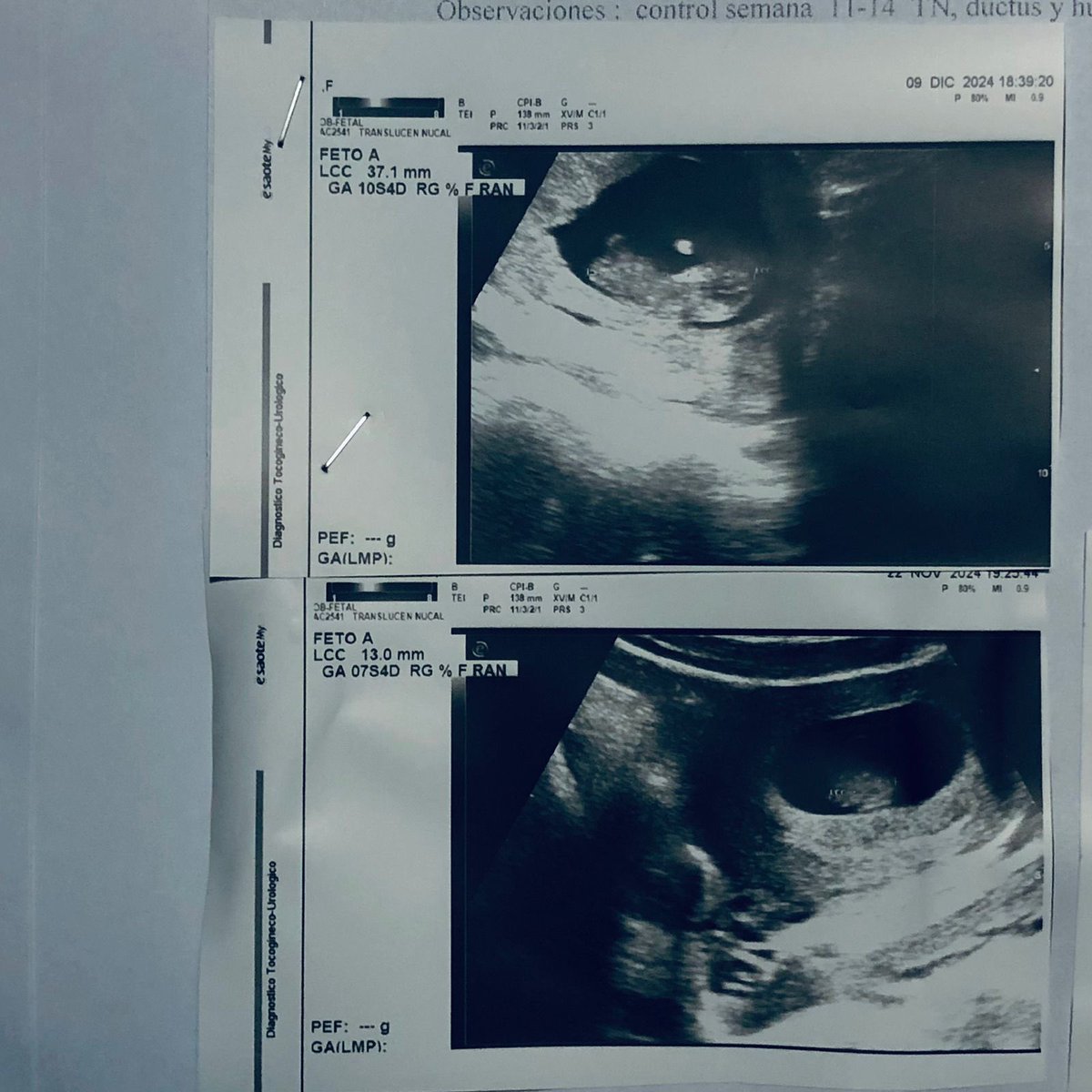 Sorpresa bonita viene en camino, no hay mejor regalo que ese amor que está creciendo en ti ❤️‍🩹🫀2024/2025!