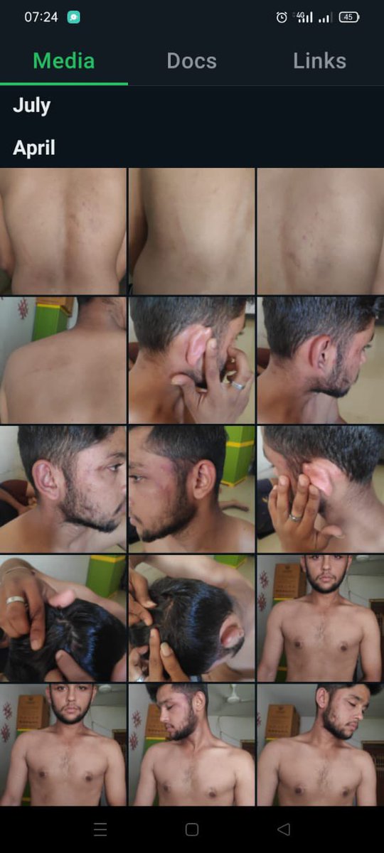 amitdeshmra's tweet photo. 5) In April 2024, he was made to stand whole day to meet his wife and daughter. When he tried to meet them, he was brutally beaten by his in laws, thrown from stairs and had suffered injuries.

6) Police allegedly refused to register a complaint against his in laws. https://t.co/gMiP7w2ZtZ