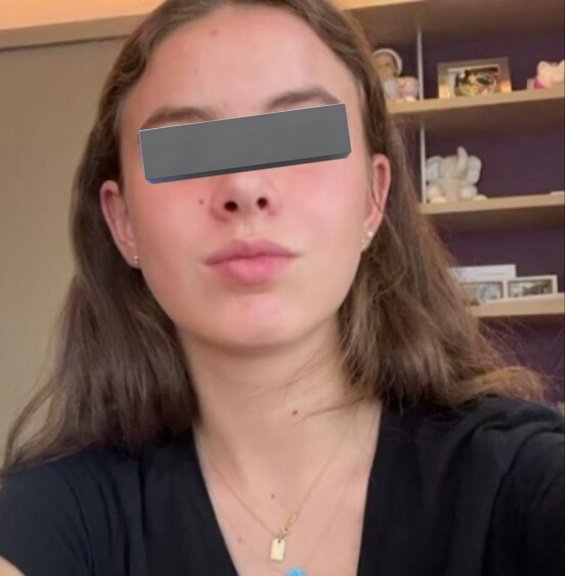Libro_negro_'s tweet photo. #FAKENEWS 🔴| En redes sociales ha comenzado una campaña de desinformación por parte de cuentas ligadas a Morena en donde aseguran que la hija de Emilio Azcarraga fue la culpable del accidente donde falleció Daniel Tadeo, eso es completamente falso pues la chica que tuvo el accidente se llama Gabriela y ella es mayor de edad, la hija de Emilio Azcarraga se llama Hanna Azcarraga y es menor de edad.

Dejen de replicar noticias falsas.

La primera fotografía es de Gabriela, quien tuvo el accidente. 

La segunda es de Hanna quien es hija de Emilio y nada tiene que ver con ese accidente. 

Vean el lunar que tiene Hanna y la diferencia de labios y rostro.