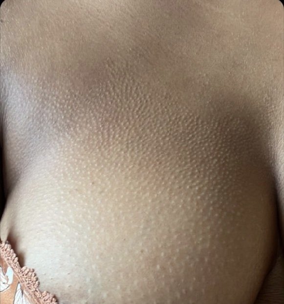 سؤال للجادين فقط 🫣 ؟؟
.
ايش يجعل الجسم يقشعر ابغى الجواب بكل صراحة وكل احترام
.
#سًُـكًُـسًُ
#سًُـكًُـسًُ_كًـتابُ