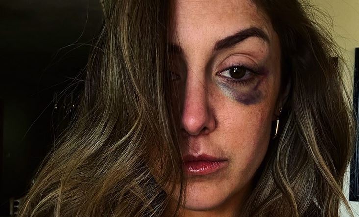 RebeccaDiamond_'s tweet image. *AND NEW! @one_wrestle Glory Champion! 
#SamsonFamily #PrincessCut #Glory43 #ANDNEW