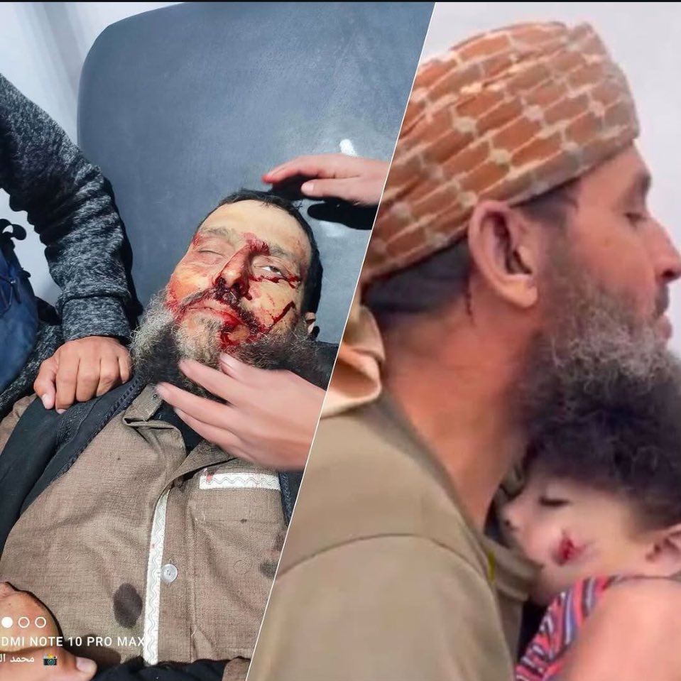 gazanotice's tweet photo. Sheikh Khaled Nabhan, known for his emotional phrase “soul of the souls” for his granddaughter Reem, was killed this morning along with several civilians in an Israeli artillery strike near Al-Qassam Mosque in Nuseirat refugee camp, Gaza. 

Last year, Nabhan gained international attention for his profound grief after Reem was killed in an Israeli airstrike, making him a symbol of Gaza’s personal tragedies.