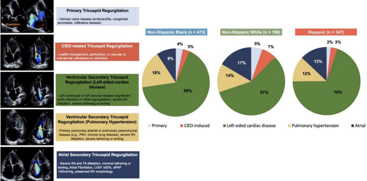 Julio Echarte (@jcecharte) on Twitter photo 💫Check our last paper from <a href="/MonteHeart/">Montefiore Heart</a> based on Race/Ethnicity disparities in severe TR <a href="/azeemlatib/">Azeem Latib</a> <a href="/AndreaScotti21/">Andrea Scotti</a> <a href="/guilbon/">Guillaume Bonnet</a> <a href="/jtorrado_arrosa/">Juan Torrado, MD, PhD</a> <a href="/MatteoSturlaM/">Matteo Sturla</a>
🎯 Black/Hispanic ➡️advanced TR disease
🎯 A-STR ⬆️ in White
➡️ Black experienced ⬆️HF 🏥
📎 surl.li/kvqekl 💫Check our last paper from <a href="/MonteHeart/">Montefiore Heart</a> based on Race/Ethnicity disparities in severe TR <a href="/azeemlatib/">Azeem Latib</a> <a href="/AndreaScotti21/">Andrea Scotti</a> <a href="/guilbon/">Guillaume Bonnet</a> <a href="/jtorrado_arrosa/">Juan Torrado, MD, PhD</a> <a href="/MatteoSturlaM/">Matteo Sturla</a>
🎯 Black/Hispanic ➡️advanced TR disease
🎯 A-STR ⬆️ in White
➡️ Black experienced ⬆️HF 🏥
📎 surl.li/kvqekl