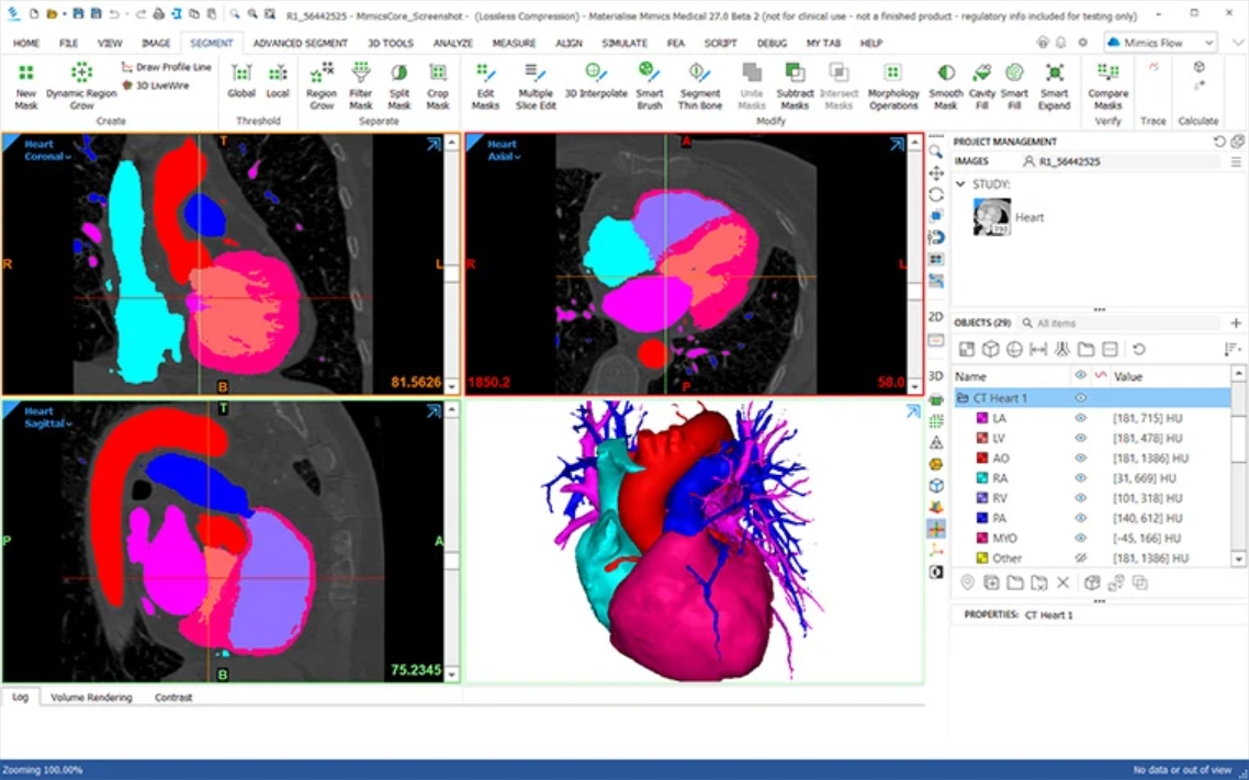 nittinpatil's tweet image. Materialise Launches Integrated Mimics Platform to Accelerate Adoption of Personalized Medical Care

dailycadcam.com/materialise-la… via @dailycadcam

@MaterialiseNV #MaterialiseMimics #PersonalizedHealthcare #Medical3DPrinting #Medical3DPlanning #MedicalDeviceIndustry #CAM