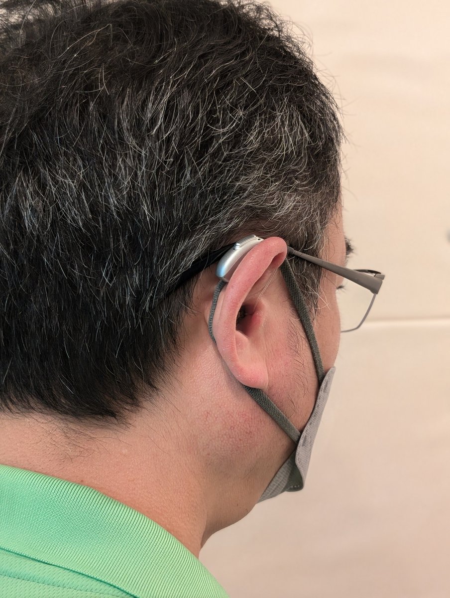 Tachikawa_HAC's tweet image. 本体がやや大きくなったので気になる方もいらっしゃると思います。マーベルとスフィアの大きさの比較。
（肌を加工しておらず申し訳ございません）
#PHONAK #infinio #sphere #補聴器 #きこえは新次元へ #立川 #補聴器