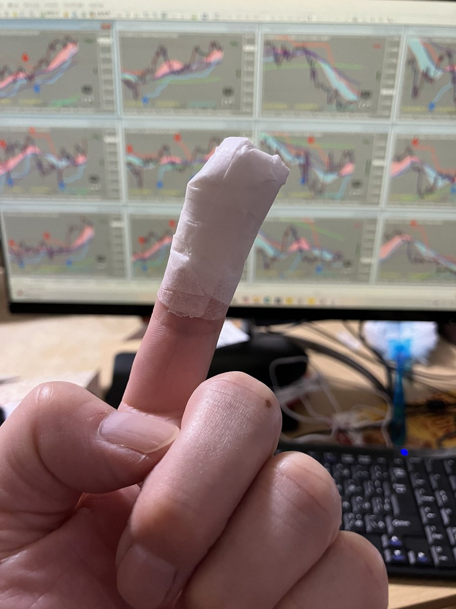 いや〜、料理してはじめて指切ったわ！w
したっけさ、うちに絆創膏なくてさ、どーしよってウロウロしててさ、血はぼたぼた出るしさ、舐めても舐めても出るから頭の上に指上げて考えた結果がガーゼがあったからガーゼ巻いて紙テープで止めてみた！w
明日絆創膏買ってこよ！w