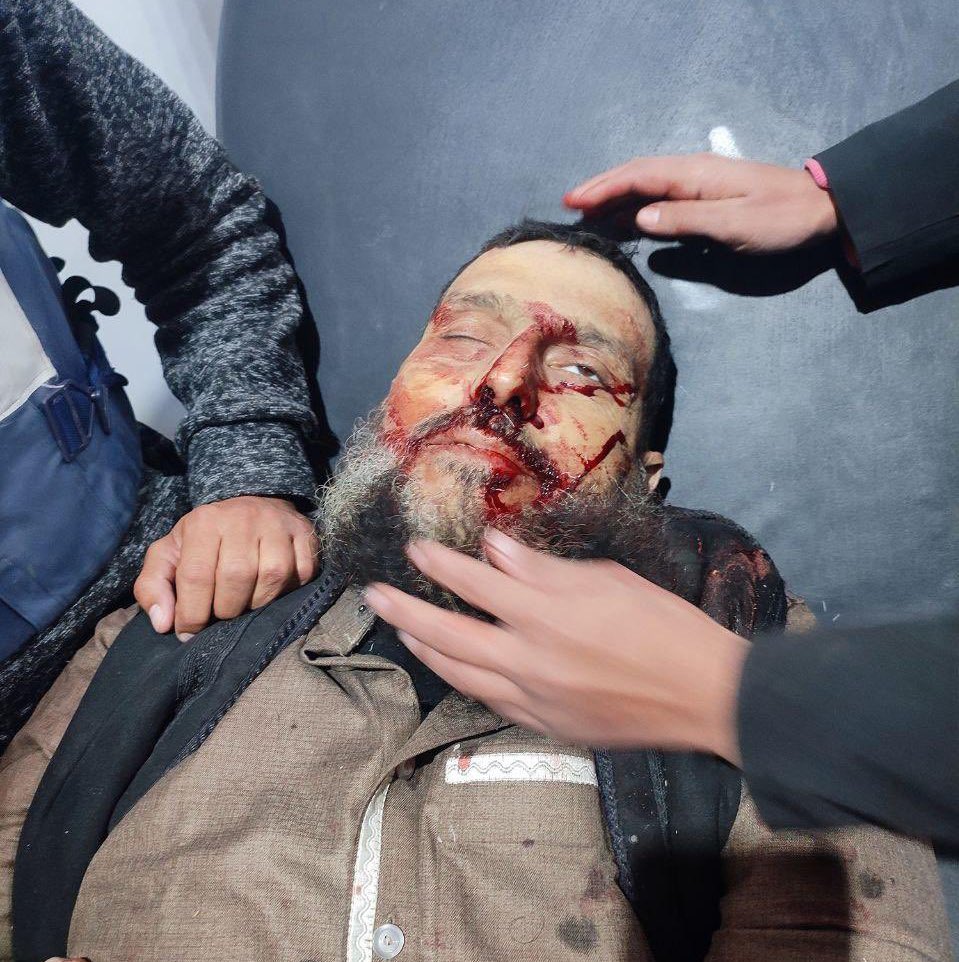 inpic0's tweet image. الشيخ ابو ضياء (خالد نبهان ) 

رحمة الله على روحه الطيبة. 
اسأل الله العظيم رب العرش العظيم أن يتقبله ويجمعه  بأهله في الفردوس الأعلى. 
إنا لله وإنا إليه راجعون ولا حول ولا قوة إلا بالله ..
نشاهدهم احياء ونودعهم امام شاشات التلفزيون ولايرجف للأمة رمش ..