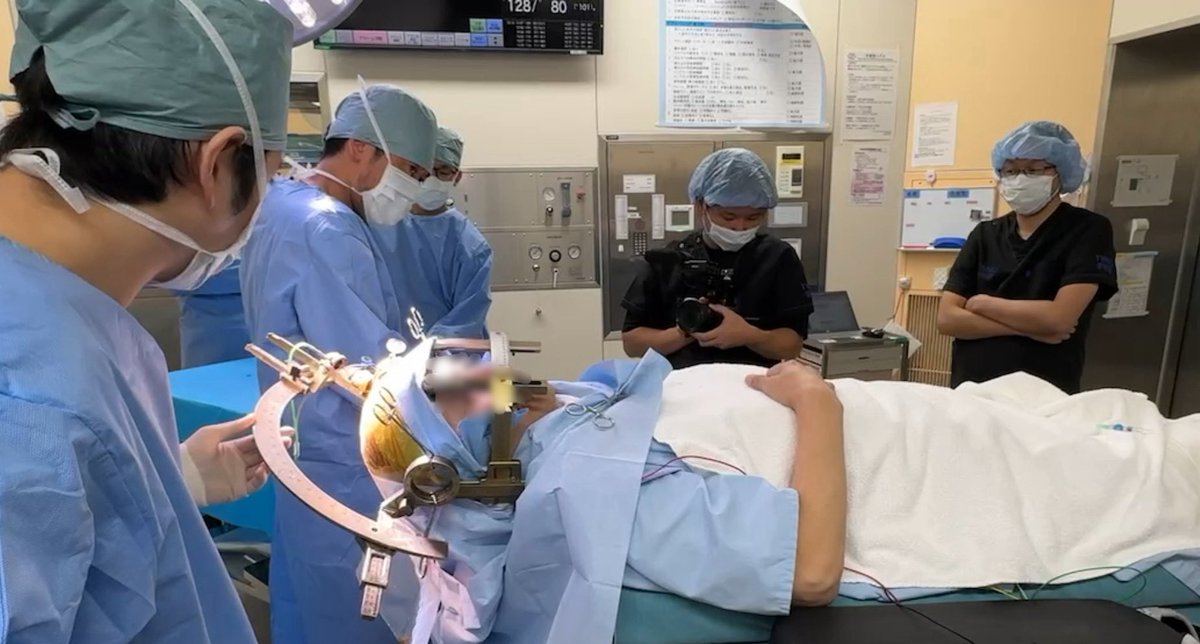 映画の撮影にご協力させて頂きました。ジストニアの研究の最先端はほぼ全て私達が関与していると言っても過言ではありません。驚くような出来事が次々と起こる私達の日常はネタに尽きない格好の材料と思います☺️
#ジストニア #振戦 #パーキンソン病