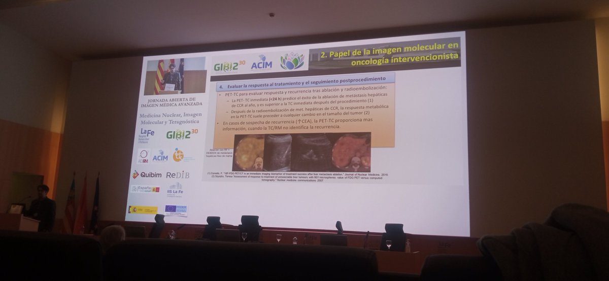 Paula_Doria_'s tweet photo. No nos podemos olvidar de la Radiología intervencionista, crucial para planificar el tratamiento y evaluar la respuesta. Nos lo enseña Maximiliano Lloret del @HospitalLaFe @GIBI230 - ACIM #Jaima #Jaima2024 https://t.co/JVASwRINqi