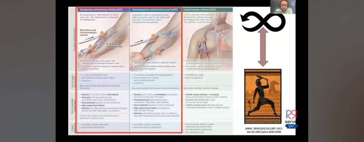 AvelRomanNeph's tweet photo. Te perdiste él excelente webinar de #Accesovascular en #Hemodialisis por la @SERVEISoc
Aca está la grabación https://t.co/zJkZvx4vwJ
#InterventionalNehrolpgy #InterventionalRadiology #VascularSurgery #Angiology https://t.co/4N6pu8GakD