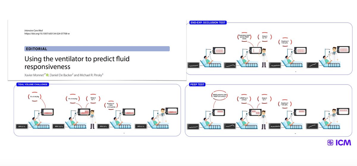 Using the ventilator to predict fluid responsiveness
🫀pulse pressure &amp; stroke volume variation (PPV &amp; SVV)
🖥️ vena cava diameter changes
🫁 Vt challenge
🫁 end-expiratory occlusion test
🫁 recruitment maneuvers
🫁 PEEP test
⁉️ how to select right tool?
🔓 bit.ly/3DfOQ6t