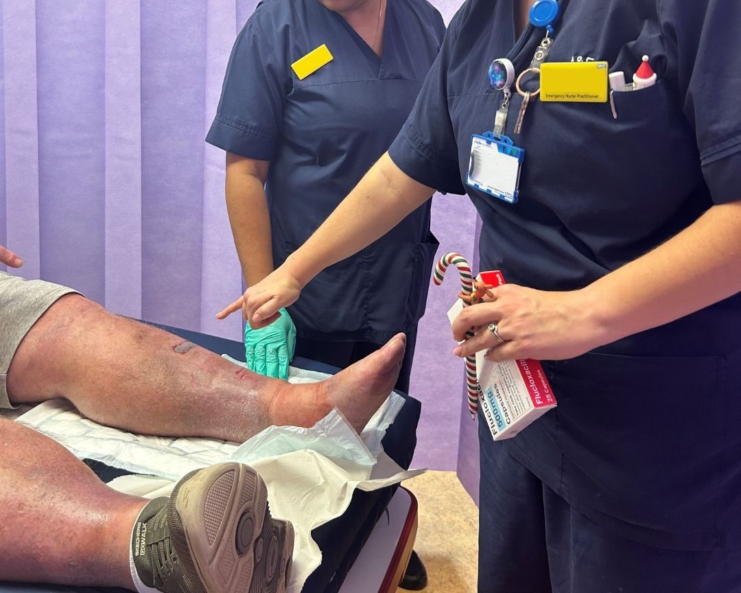 NHSSussex's tweet photo. After injuring his leg, Chris paid a visit to his local Urgent Treatment Centre (UTC).

"In just a few hours, the wound was all cleaned up and bandaged. And with a course of antibiotics, I was sent on my way!"

Find out more about UTCs:

https://t.co/pUjUUgKqhS https://t.co/v2CeYvdU1N