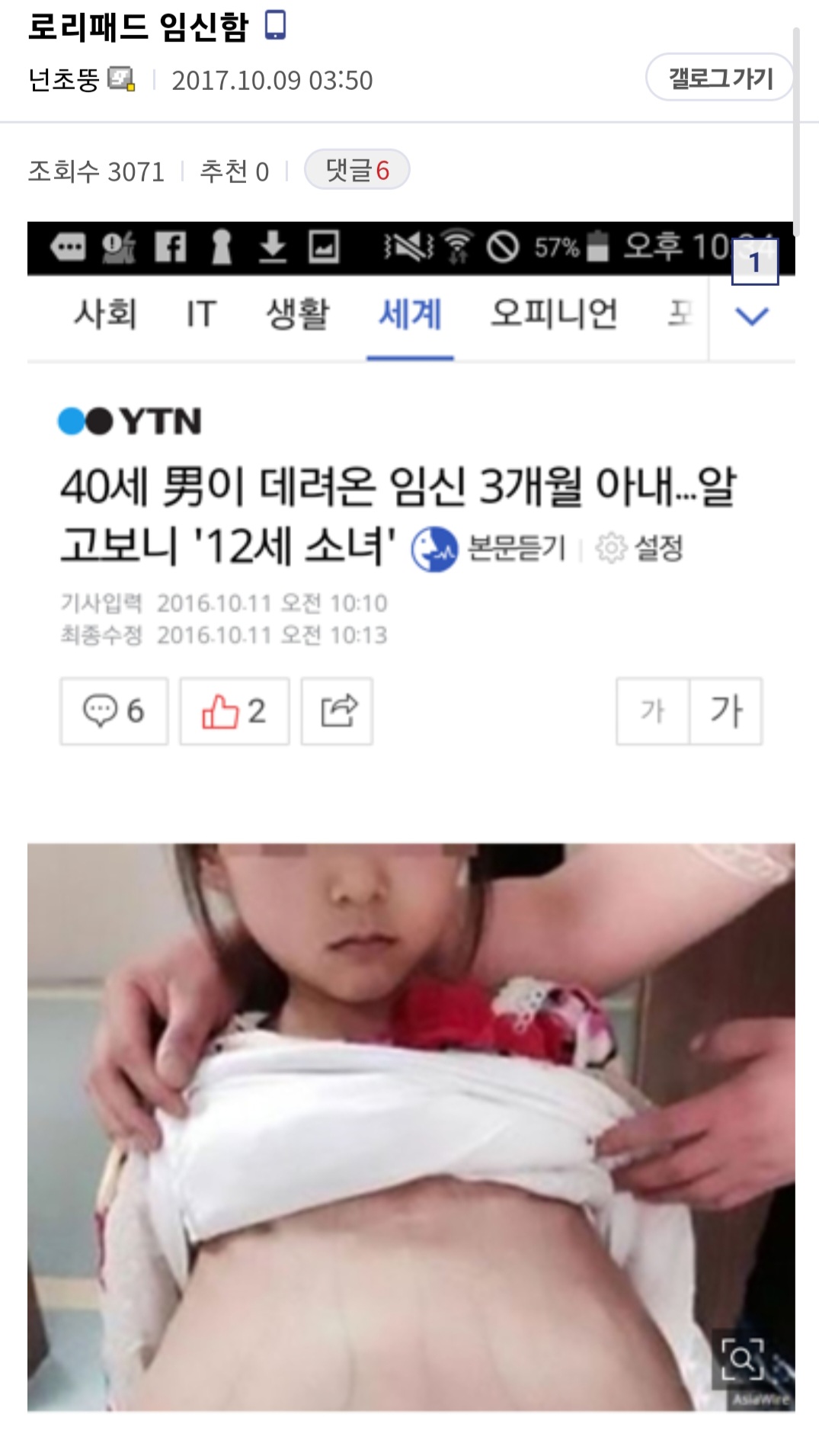 로리패드 