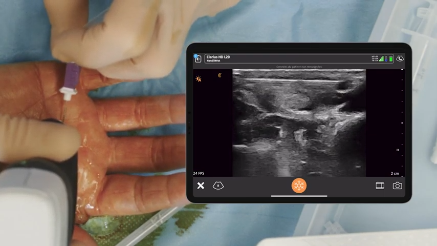 clariusmhealth's tweet photo. We hope to see you at GEM this week! 

📅 December 19-21, 2024
📍 Booth #30
🌍 Paris, 🇫🇷 

Discover how the Clarius L20 HD3 can enhance surgical outcomes and follow-ups with real-time, high-resolution imaging of the hand and wrist. Learn more 👉 https://t.co/pFFBn6qS6D https://t.co/oitHaZhIno