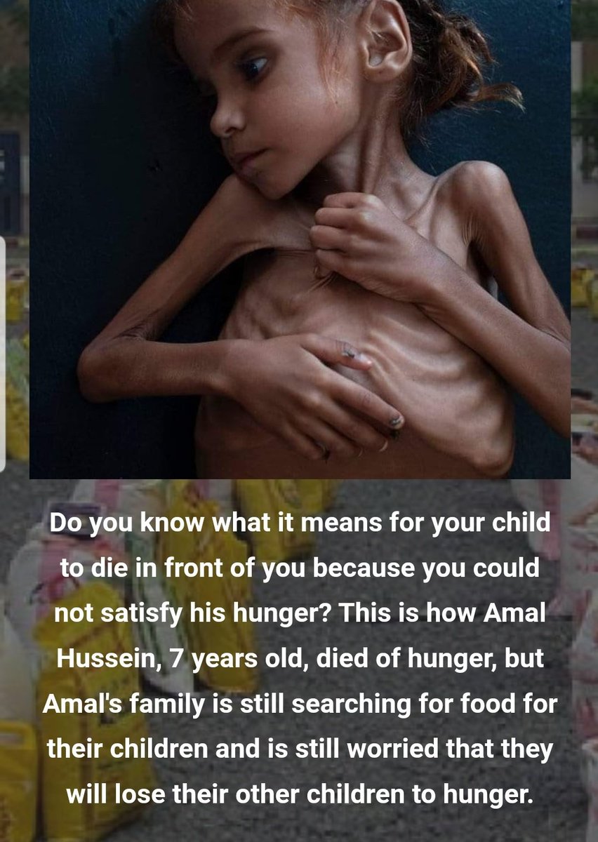 Yourabilities_o's tweet photo. know what it means for your child to die in front of you because you could not satisfy his hunger?This is how Amal Hussein, 7 years old, died of hunger, but Amal's family is still searching for food for their children and is still worried that they will lose their other children https://t.co/cALu31VKU7
