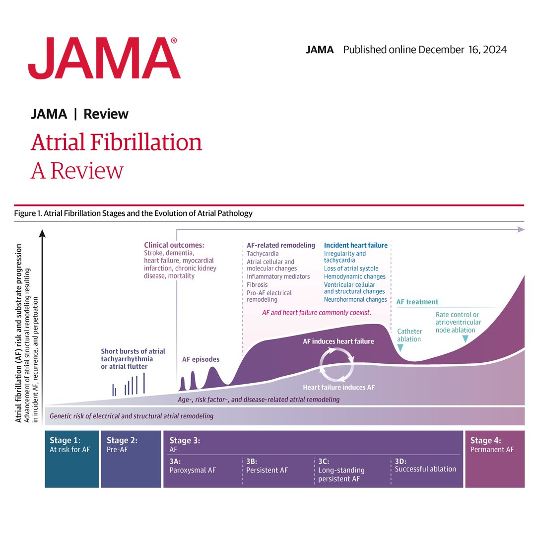 Atrial fibrillation (AF) is associated with increased rates of stroke, heart failure, and mortality. This narrative review examines the epidemiology, pathophysiology, diagnosis, and treatment of AF. 

ja.ma/3ZDdZ2D