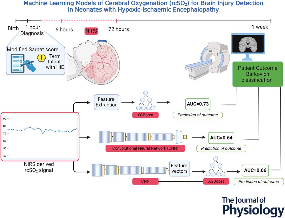 INFANT Centre (@infantcentre) on Twitter photo Congratulations to Minoo Ashoori & <a href="/FB_McD/">Fiona McDonald</a> on their recent publication - The use of Machine Learning models of Cerebral Oxygenation for brain injury detection in neonates with HIE.
<a href="/UCCResearch/">UCC Research</a>
<a href="/NewbornBrains/">Newborn Brain Society</a>
<a href="/infantcentre/">INFANT Centre</a>
<a href="/ESPR_ESN/">European Society for Paediatric Research (ESPR)</a>
physoc.onlinelibrary.wiley.com/doi/10.1113/JP… Congratulations to Minoo Ashoori & <a href="/FB_McD/">Fiona McDonald</a> on their recent publication - The use of Machine Learning models of Cerebral Oxygenation for brain injury detection in neonates with HIE.
<a href="/UCCResearch/">UCC Research</a>
<a href="/NewbornBrains/">Newborn Brain Society</a>
<a href="/infantcentre/">INFANT Centre</a>
<a href="/ESPR_ESN/">European Society for Paediatric Research (ESPR)</a>
physoc.onlinelibrary.wiley.com/doi/10.1113/JP…