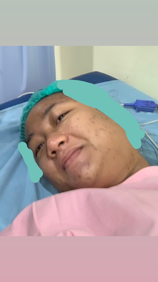 wedorehhh's tweet photo. @skinatvelvet YaAllah mbak sama😭 pengen sambat tapi semua org bilang bla bla bla😭. Ini foto diambil suami sebelum sc😭😭😭 seperti beda org. Makanya selama hamil gamau ketemu temen temen😭 takut ditanyain aneh aneh dan di hujat😭 https://t.co/pn5dXzqnTu