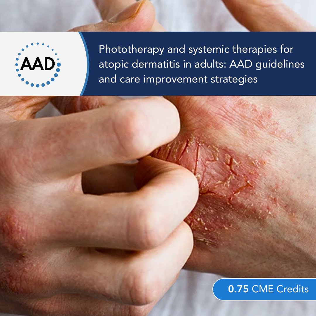 A new #CME course on AAD guidelines for phototherapy and systemic therapies for #atopicdermatitis is now available. You’ll learn to identify recommended treatments, describe potential adverse effects, identify performance indicators, and more... learning.aad.org/Users/Learning…