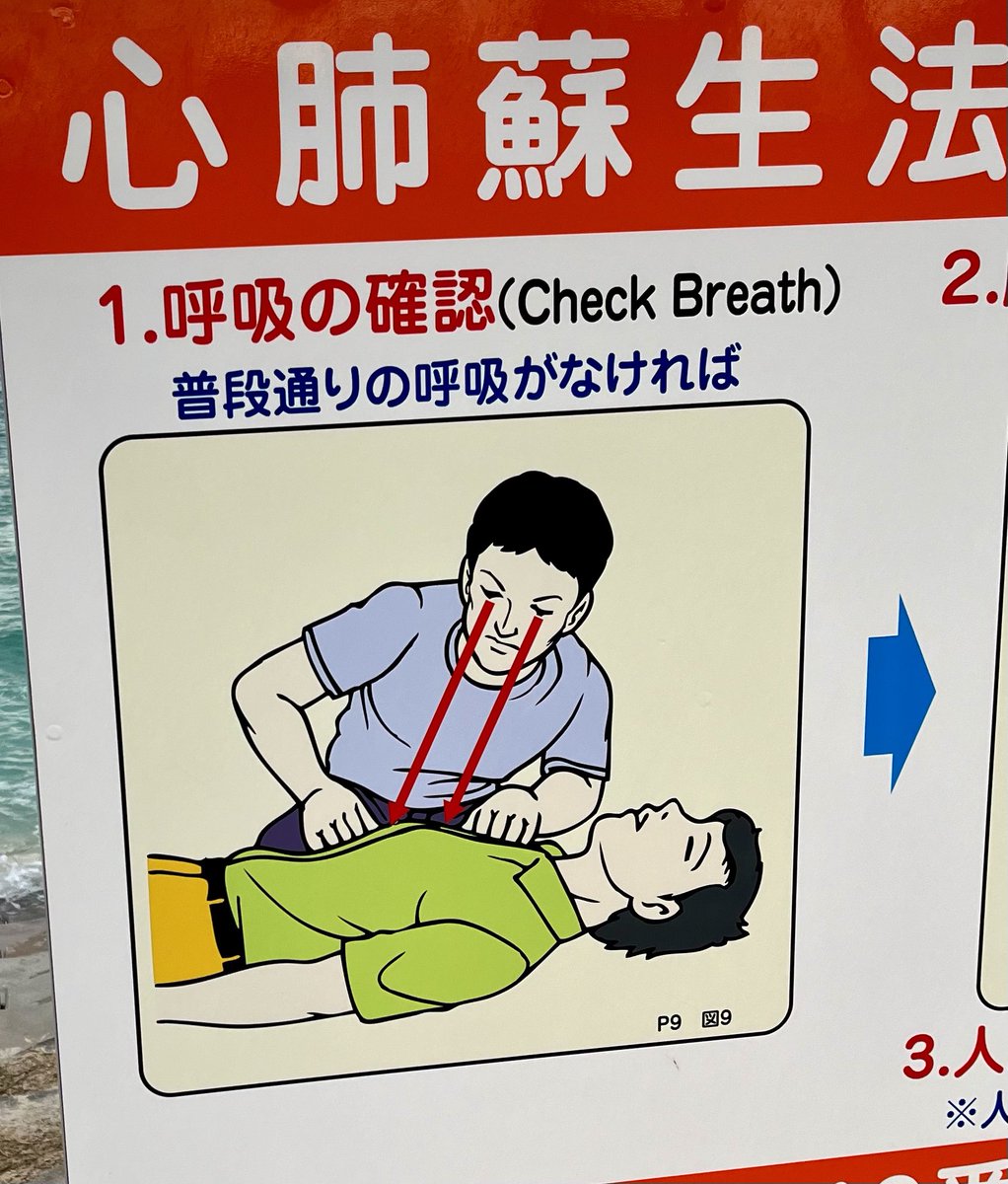 Find signs entertaining.  This is explaining CPR (on a beach). I know the red lines indicate how you should monitor the rise and fall of the chest but it looks like lasers coming no out her eyes. 

Saw the same about keeping your eyes on your babies.