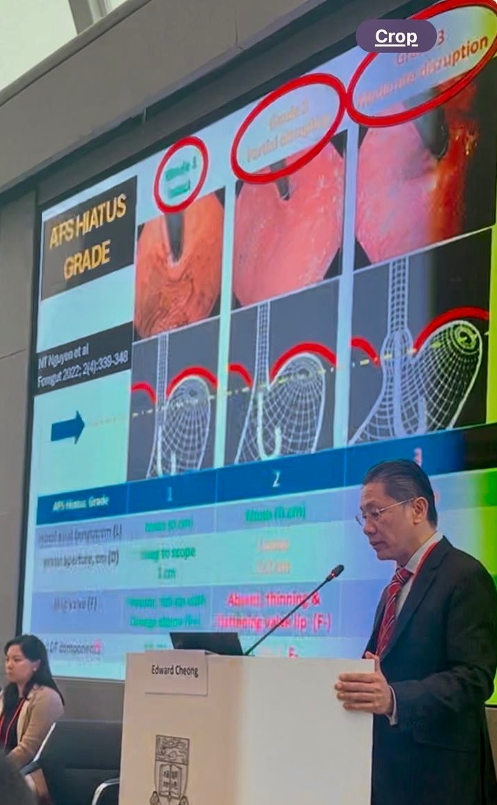 ForegutSociety's tweet image. John Lipham and Prakash Gyawali spent some time in Hong Kong this weekend at the Hong Kong Foregut Masterclass. The AFS grade made an appearance as well!
#BetterTogether #AFS2024