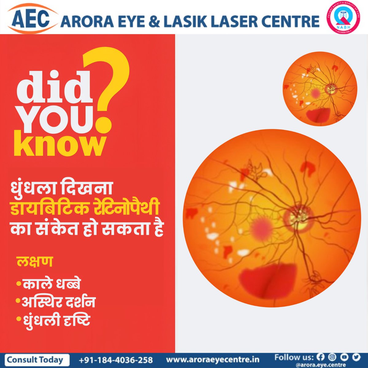 aroraeyecentre's tweet photo. डायबिटिक रेटिनोपैथी उपचार - Arora Eye Centre में 

अपॉइंटमेंट बुक करें।
📍650, Sec. 7, Urban Estate Karnal (Haryana)
📞+91-184-4036-258 
🔗https://t.co/G5kZhpZ8o3

#DiabeticRetinopathy #EyeCare #AroraEyeCentre #VisionHealth #SpecializedTreatment https://t.co/APf6EmmuIp