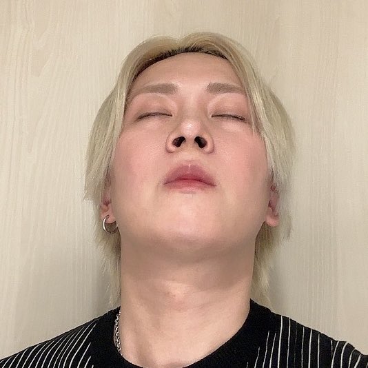 jin_623_'s tweet photo. 〜ダウンタイム4ヶ月経過〜

先月とそんなに変わらないように見えるけど腫れが引いてる感覚はある🙆‍♀️
あとは顎周りの腫れが引いてきたらもっとわかりやすいと思うけどそれはまだもう少しかかりそうかな🤔

#id美容外科 #韓国整形 #骨切り
#両顎手術 #Vライン形成
#ルフォー #ssro https://t.co/D0g9sPqUs7