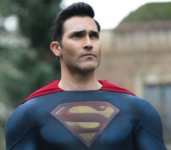 BrasilSuperman's tweet photo. O LEGADO DO SUPERMAN!

Tyler Hoechlin falou sobre David Corenswet como Superman:

"Estou muito honrado e privilegiado por ter feito parte disso e super feliz em passar isso para David . Tenho certeza de que ele fará um ótimo trabalho". https://t.co/PpRPbUNuEt