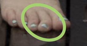 davmarkus's tweet photo. @itsjuststephfox U broke yr finger? https://t.co/iUbUqwvzKv