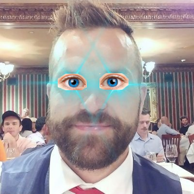 Laser Eyes deactivated.  

<a href="/ICOffenderII/">yellow.🍌🍞</a> you're a legend.