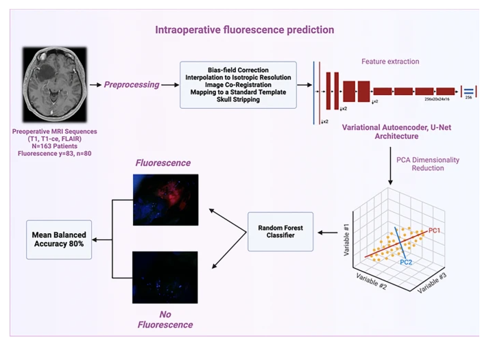 PrazNeuro's tweet photo. AI model predicts intraoperative 5-ALA fluorescence in gliomas lacking typical high-grade MRI features from Molina et al in @JNeurooncol.

Model: variational auto-encoder and RF classifier
Accuracy: 80%
Paper: https://t.co/mGHQImyBl8

#AI #glioma #5ALA #flourescence #LGG https://t.co/ebXv8Yw8hP