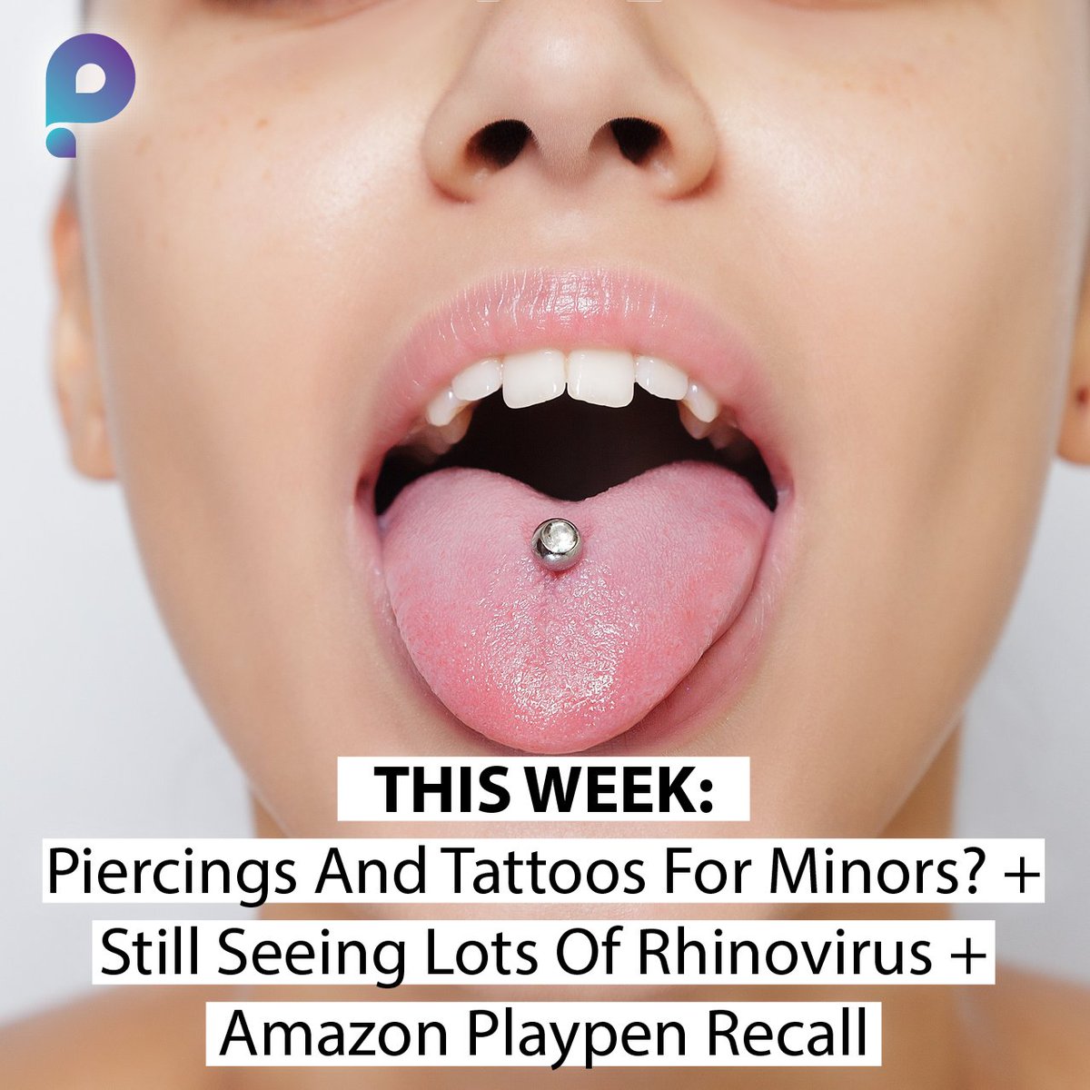 PediatricAnswer's tweet image. Some interesting info about the legality of piercings and tattoos for minors in your state. 😮

(Especially looking at you, Idaho, Mississippi, and So. Carolina.)

pediatricanswers.com/p/piercings-an…