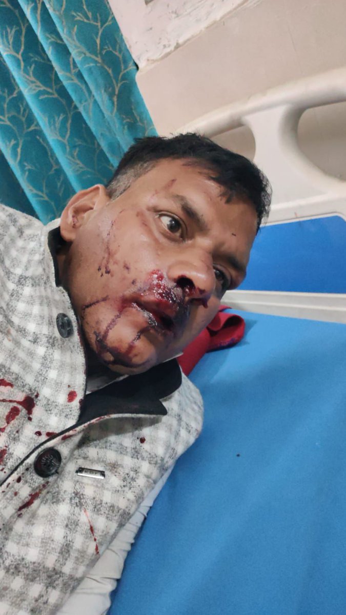 hanyyadav's tweet photo. पुलिस ने पुलिसवालों की भी रिपोर्ट अभी तक दर्ज नहीं  की है  ये कैसा उत्तर प्रदेश है जहां zero टॉलरेंस नीति लागू है
@CMOfficeUP @dgpup @DgPrisons @aligarhpolice 
@myogiadityanath @yadavakhilesh https://t.co/uhx0AsANCk