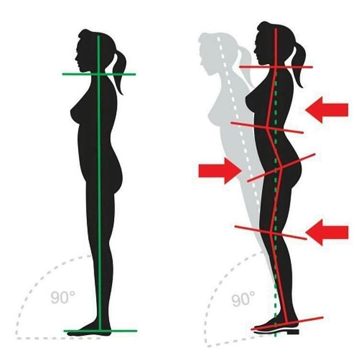 willzolpe's tweet photo. Hokas are a scam.

About 13% of US adults own a pair of Hokas.

They're trusted to improve running and help pain, but that's very misleading.

Here's why: https://t.co/MZe5Z7lNl3
