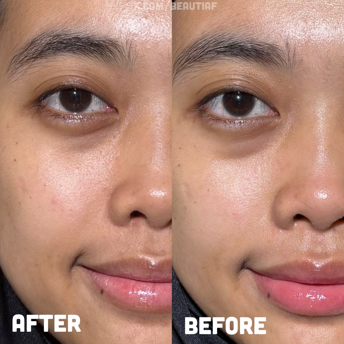beautiaf's tweet photo. tips hemat: ngilangin bekas jerawat dan ngurangin flek pakai produk BRIGHTENING yang ada SYMRADIANCE 399-nya!🌟

laser ke dokter mahal, mendingan pake produk ini karena ✨GONG✨ buat ngilangin bekas jerawat dan bikin muka glowing-fresh🤝🏻 https://t.co/QMAcS24hkn