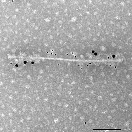 Engineered tobacco etch virus with two genetically-encoded nanobodies on the surface. Nanobodies are visualized through binding to gold spheres of different diameter. doi.org/10.1021/acsnan…. Novel plant-derived nanomaterial with exciting potential applications in nanomedicine.