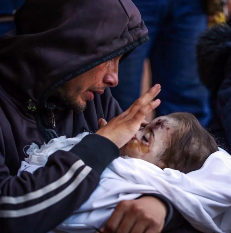 GuerraenlaUni's tweet photo. Cuando la mayor parte de imágenes que llegan de un conflicto son como las de la izquierda, es probable que sea una guerra. Cuando la mayor parte de imágenes que llegan son como las de la derecha, es probable que sea un genocidio. A ver si así nos aclaramos. https://t.co/8iEcr1S8OD