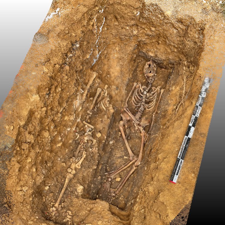 Unité de Taphonomie Médico-Légale & Anatomie tweet media