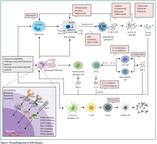 NEW REVIEW—Yujie Shen and colleagues discuss personalised precision treatment for Still's disease based on molecular characteristics and disease progression thelancet.com/journals/lanrh…
