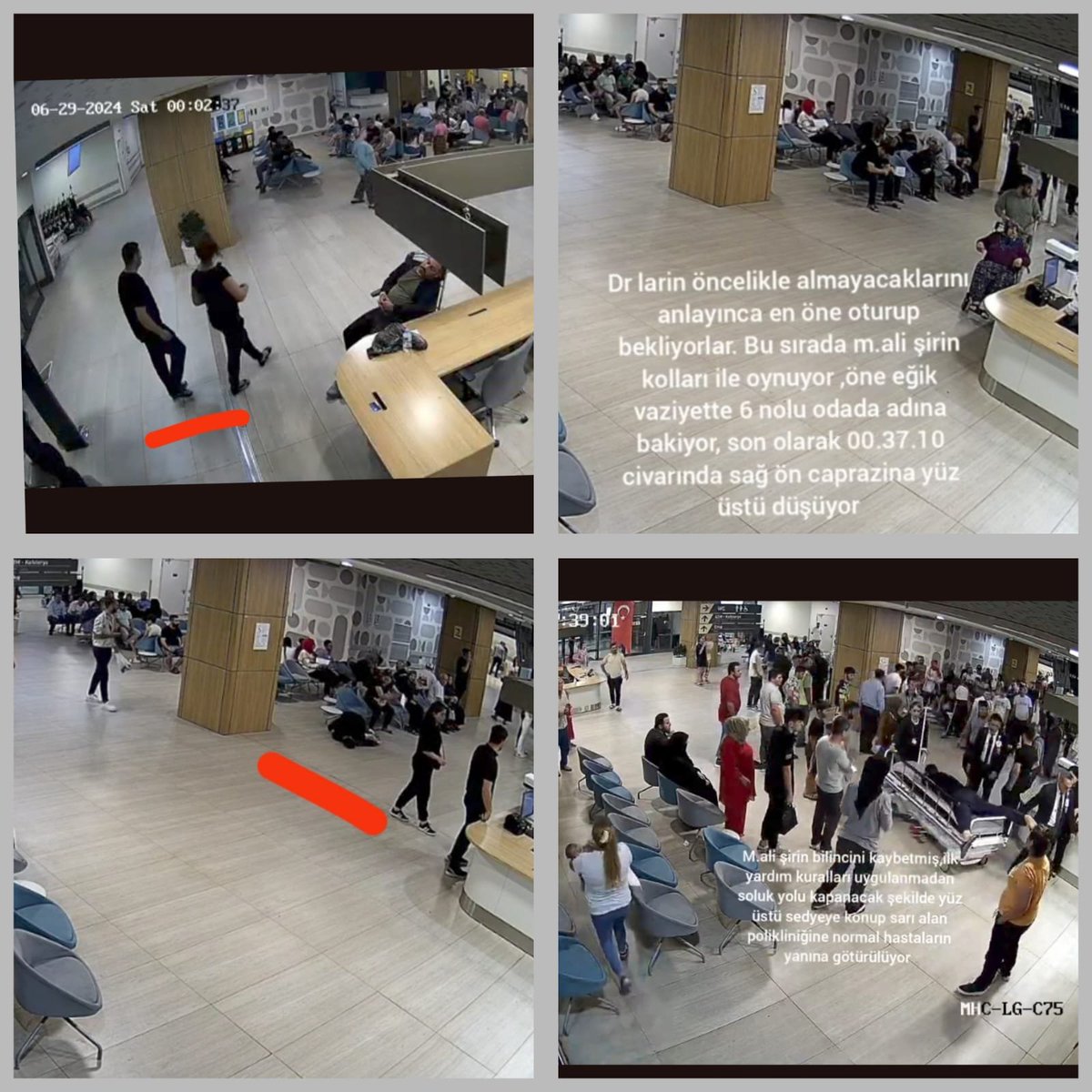 TurhanBozkurTV's tweet photo. 🚨 Ayşe: "Gaziantep Şehir Hastanesi'ne kol uyuşması, göğüs ağrısı ve kalp krizi şüphesi ile eşimle yürüyerek gittik.

🗣️ Aciliyetimizi defalarca söylediğimiz hâlde EKG dahi çekilmedeği gibi hekimlerden azar işittik. 

🫀 Kimse ilgilenmeyince 'Tek çaremiz beklemek' diyerek, beklemeye başladık. 

🚨 Eşim bu esnada yere yığıldı ve yüzüstü bir şekilde güvenlikler sedyeye koydu.

🗣️ Eşim sedyeye yüzüstü konduğu hâlde hiçbir hekim dakikalarca eşime temas dahi etmedi. 

💉 Daha sonrasında eşime 'Diyazem' denen kalp durdurucu etkisi olan bir iğne vurularak durmuş olan kalbi tamamen dönülmez bir yola konduğunu öğrendim

📸 Kamera görüntülerini ve epikriz raporlarını aldığımızda daha da şoke olduk. 

💢 Biz hastaneye yürüyerek ve kalp krizi olduğundan şüphelenerek gittik. 

🗣️ 37 yaşında 2 küçük çocuğu olan eşim Gaziantep Şehir Hastanesi'nde öldü. Çocuklarım her gün ağlıyor. Lütfen sesimiz olun sorumlular bulunsun."
