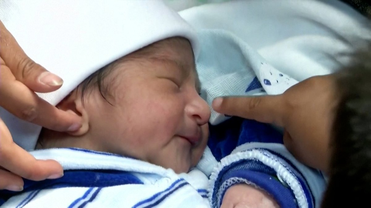 Le syndrome du loup-garou détecté chez plusieurs bébés à cause d’un médicament populaire contre la calvitie
➡️ l.leparisien.fr/j8II