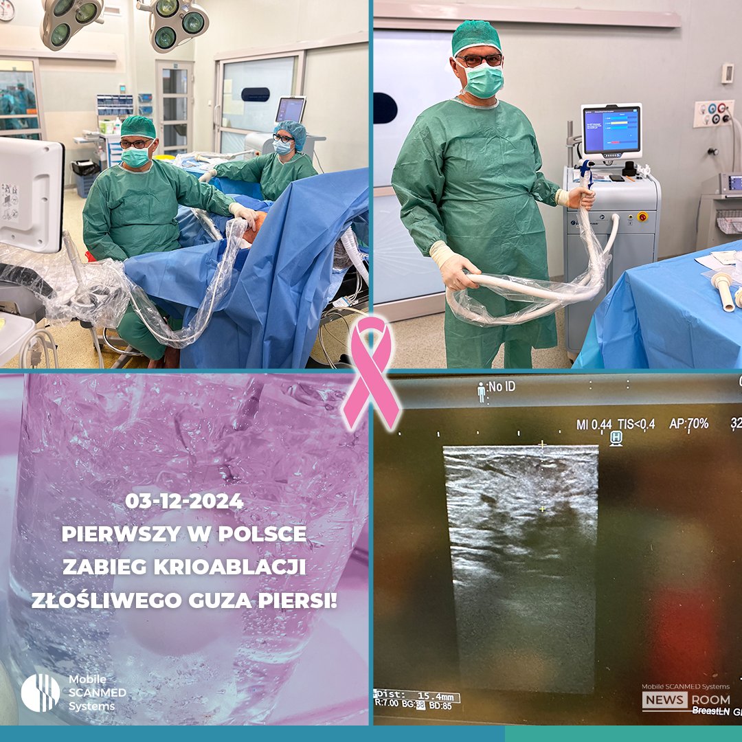 MobileScanmed's tweet photo. #Krioablacja złośliwych guzów piersi nabiera rozpędu. Ta szeroko stosowana na świecie technologia jest już także opcją leczenia w Polsce. W Penta EMC Szpitale we Wrocławiu dr n. med. Tomasz Sędziak wykonał pierwszy w Polsce zabieg krioablacji #ProSense złośliwego guza piersi. https://t.co/JU7g1RNvRa